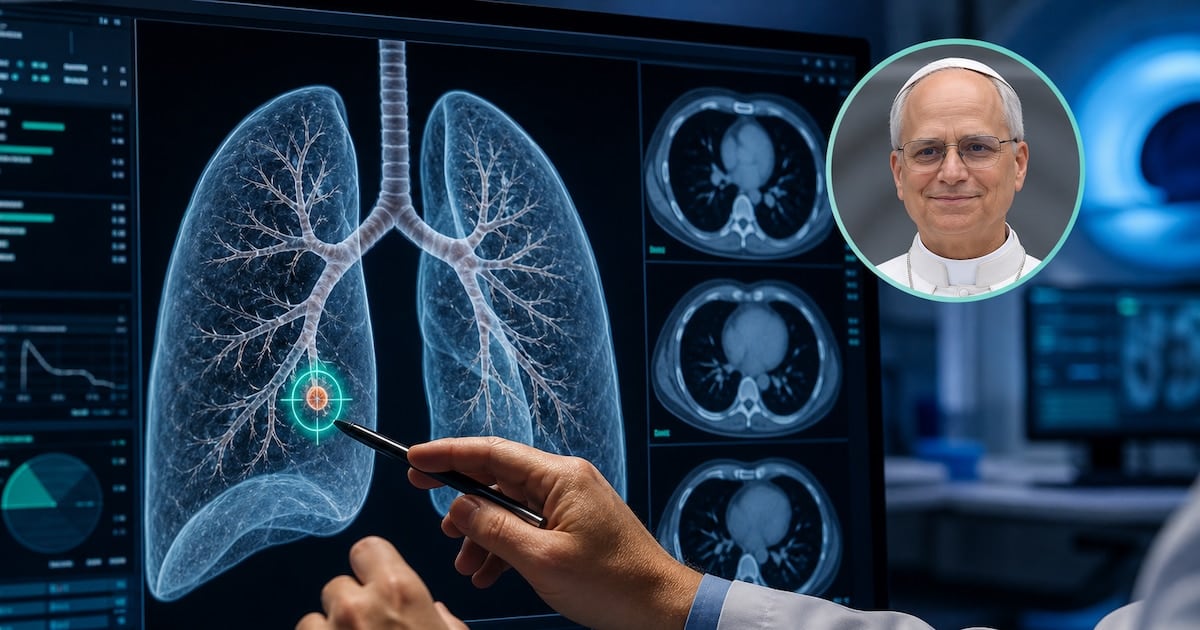 Nódulo pulmonar: por qué los médicos recomiendan operar incluso cuando la lesión mide apenas tres milímetros
