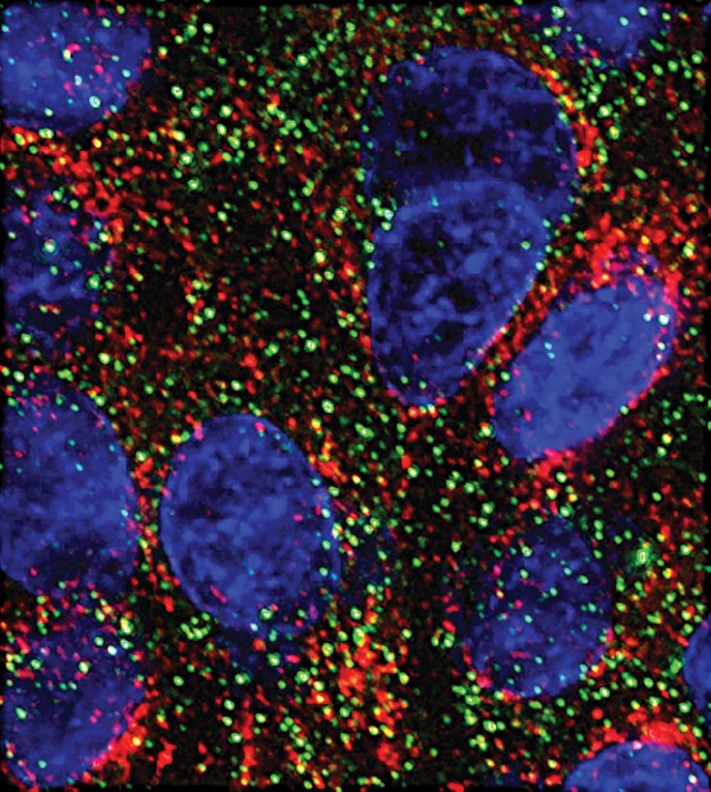 MicroARN frenan células pancreáticas en el laboratorio y abren un camino de investigación